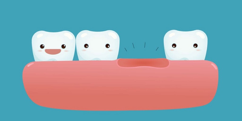 Mộng thấy rụng răng không phải trường hợp hiếm gặp